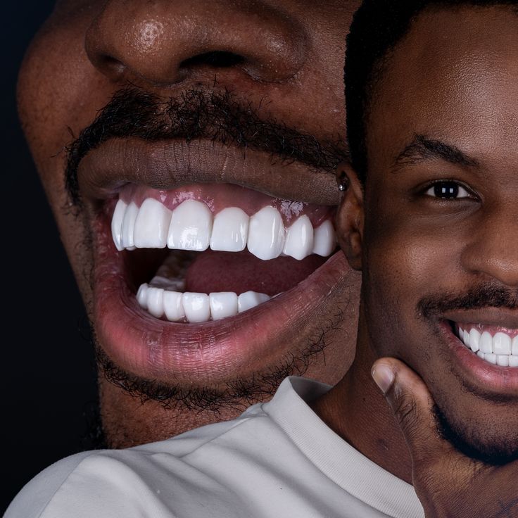🦷 RETROUVE UN SOURIRE BLANC ET FRAIS… SANS EFFORT, DÈS AUJOURD’HUI