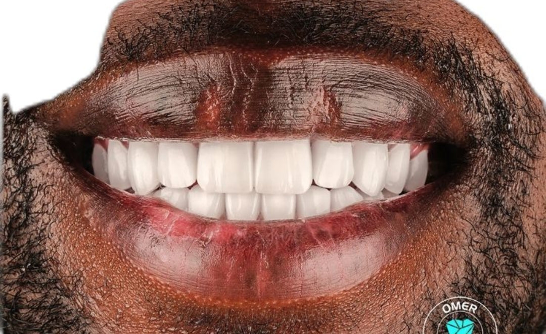 🦷 RETROUVE UN SOURIRE BLANC ET FRAIS… SANS EFFORT, DÈS AUJOURD’HUI