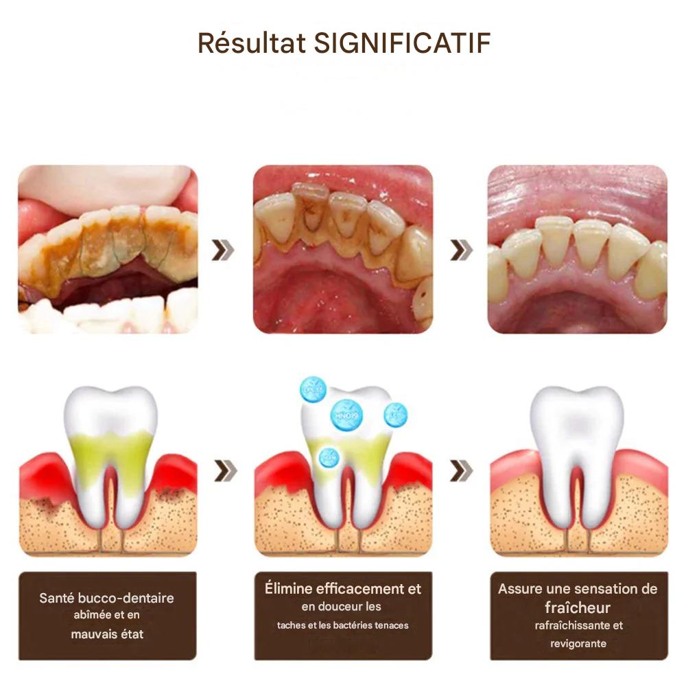 🦷 RETROUVE UN SOURIRE BLANC ET FRAIS… SANS EFFORT, DÈS AUJOURD’HUI