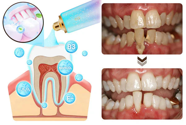🦷 RETROUVE UN SOURIRE BLANC ET FRAIS… SANS EFFORT, DÈS AUJOURD’HUI