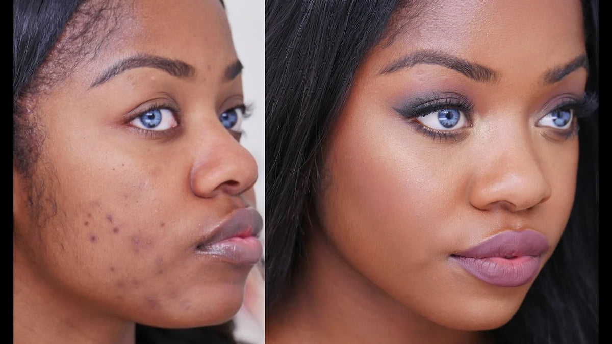 En 7 jours seulement redonne de lecar a votre visage avce Creme 345 DR. Althea